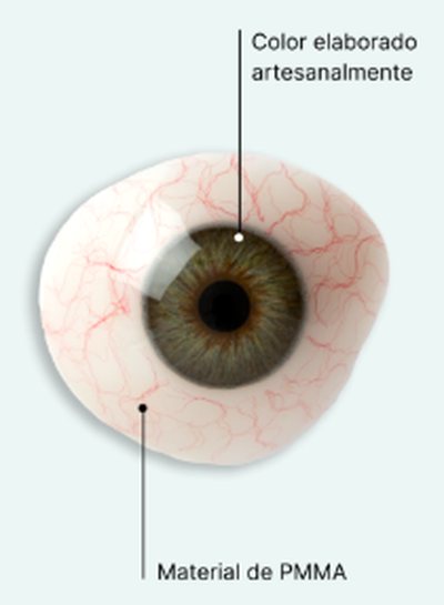 Prótesis ocular de PMMA con iris pintado a mano